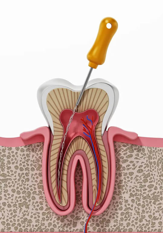 Dental-Conditions-St Helena