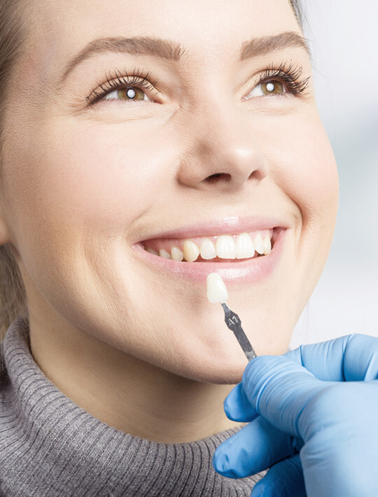 Dental-Laminate-St Helena