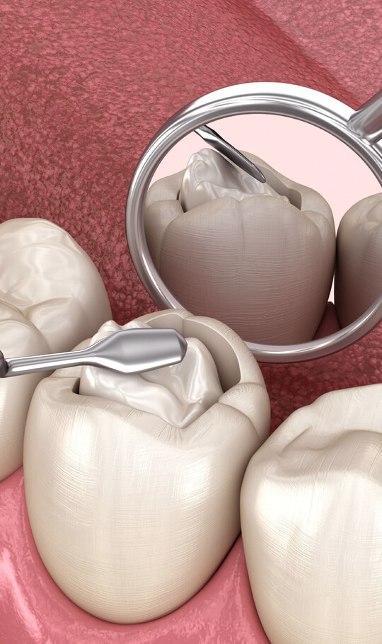 How-Effective-Are-Composite-in-St Helena
