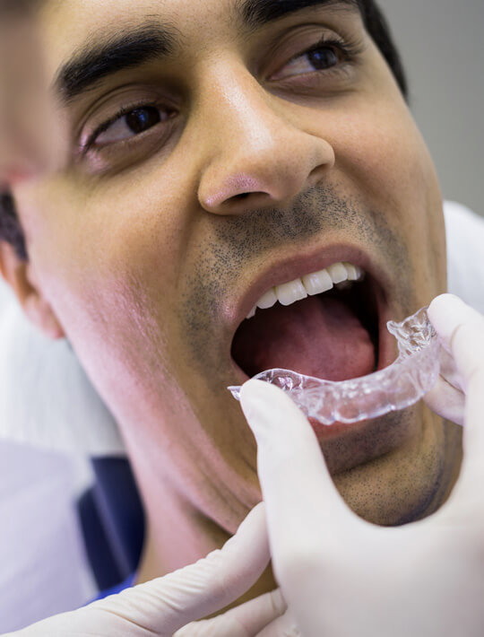invisalign-in-St Helena1