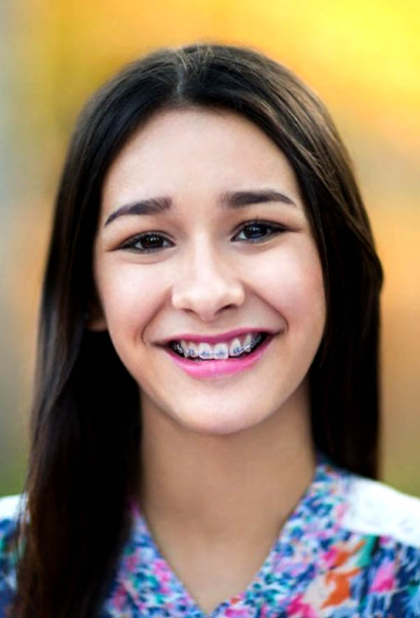 Braces For Teens St Helena