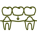 Crowns and Bridges