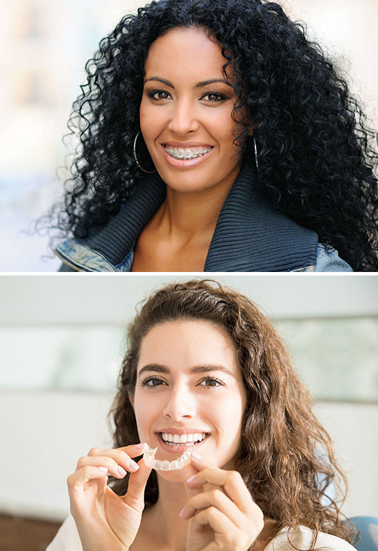 Invisalign Vs Traditional Braces St Helena