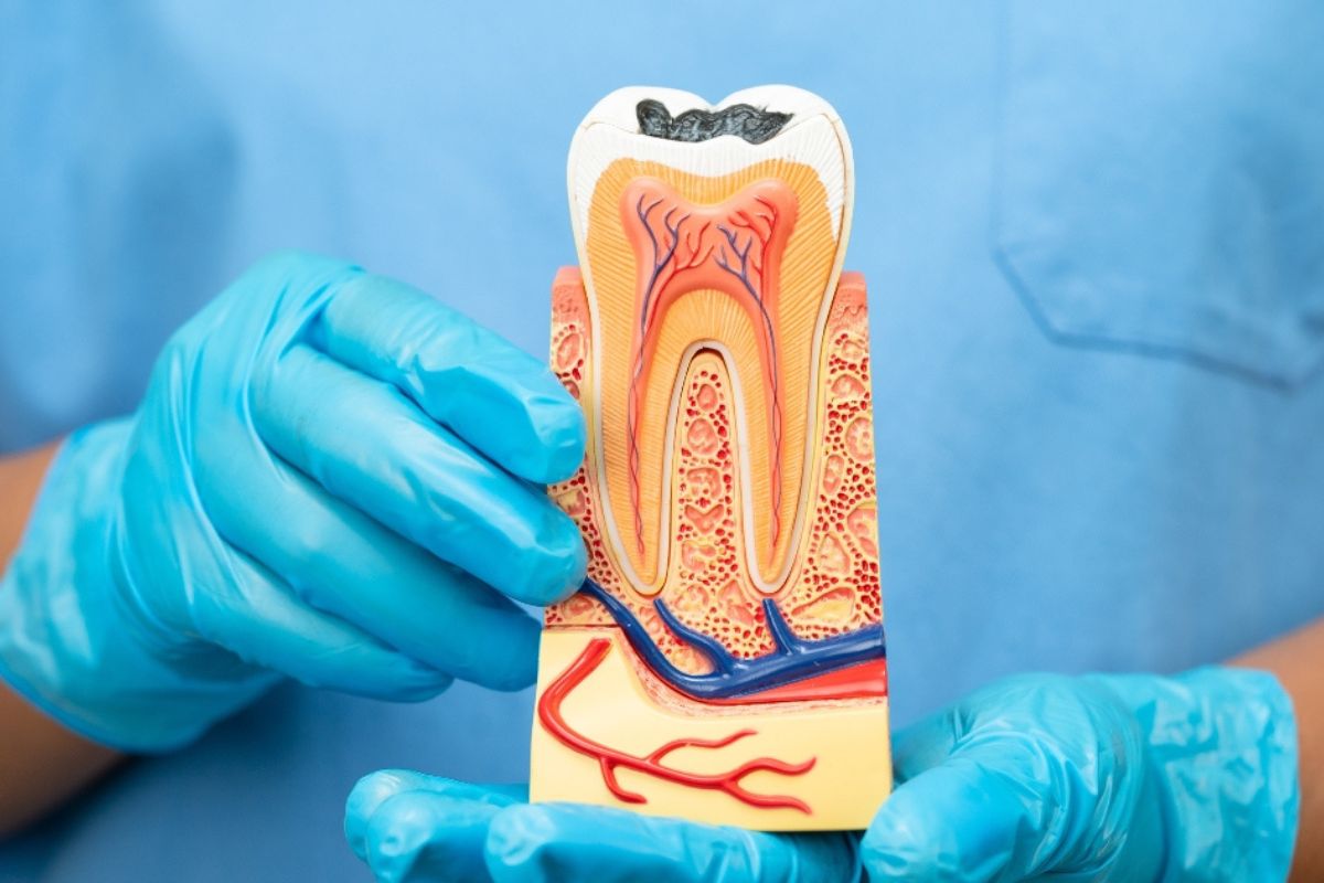 Common Signs You May Need a Root Canal Treatment