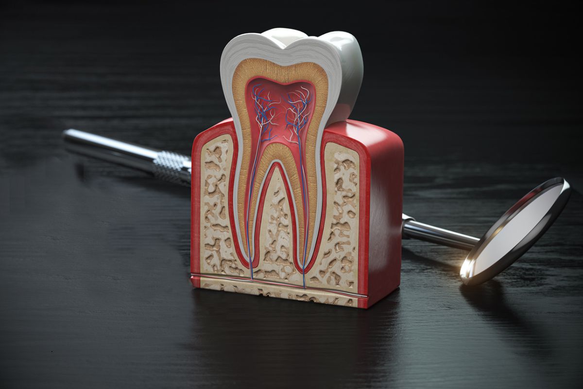 Signs You Might Need a Root Canal