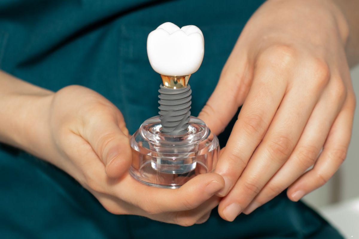 Reasons People Choose Dental Implants