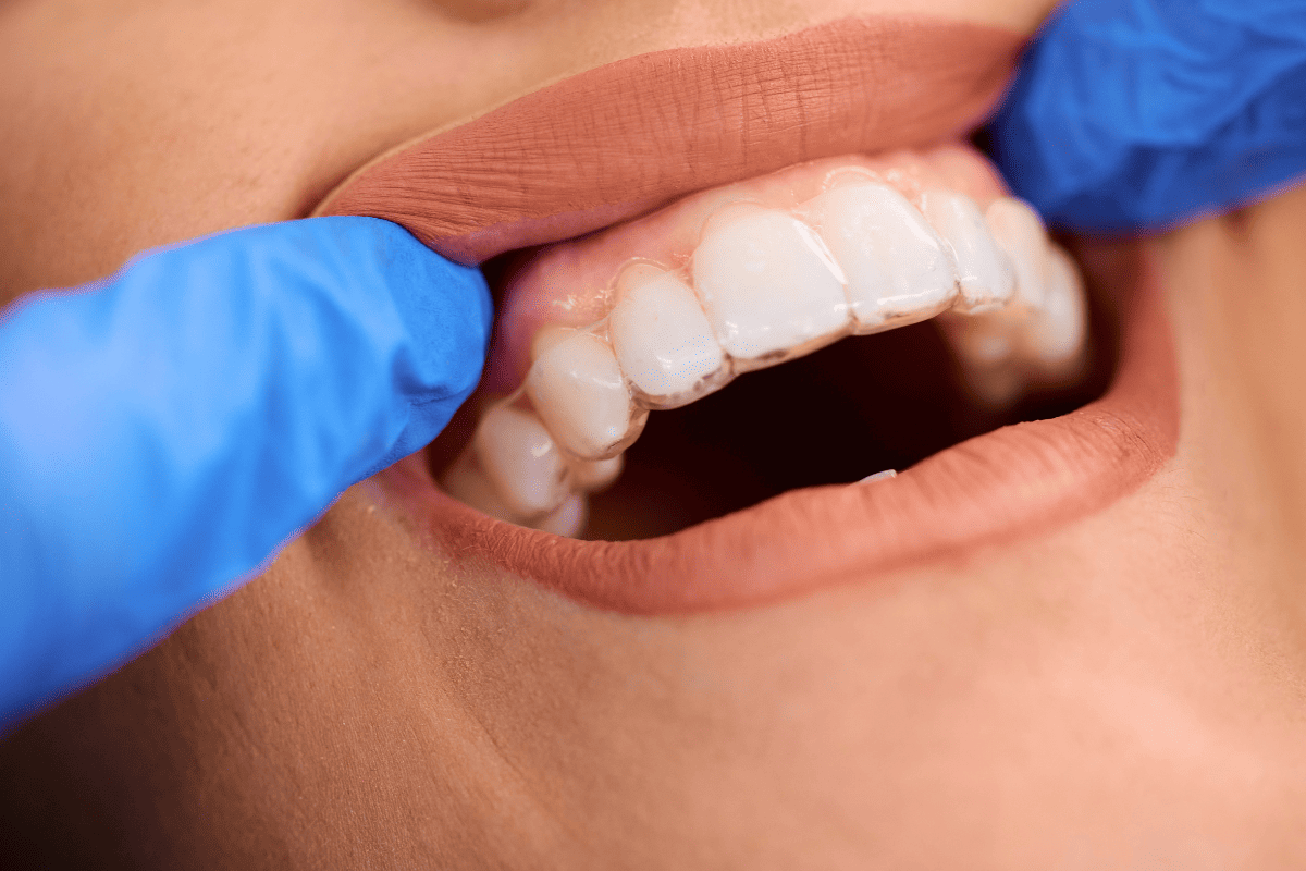 Invisalign St Helena